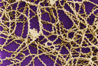 Leptospires are long, thin motile spirochetes that may be free-living or associated with animal hosts and: survive well in fresh water, soil, and mud in tropical areas. Organisms are antigenically complex, with over 200 known pathogenic serologic variants. Molecular taxonomic studies at CDC and elsewhere have identified 13 named and 4 unnamed species of pathogenic leptospires. Leptospirosis causes a wide range of symptoms, and some infected persons may have no symptoms at all. Symptoms of leptospirosis include high fever, severe headache, chills, muscle aches, and vomiting, and may include jaundice (yellow skin and eyes), red eyes, abdominal pain, diarrhea, or a rash. This scanning electron micrograph (SEM) depicts a number of Leptospira sp. bacteria atop a 0.1. µm polycarbonate filter. Caption and Image from Centers for Disease Control and Prevention Public Health Image Library, Atlanta, GA).